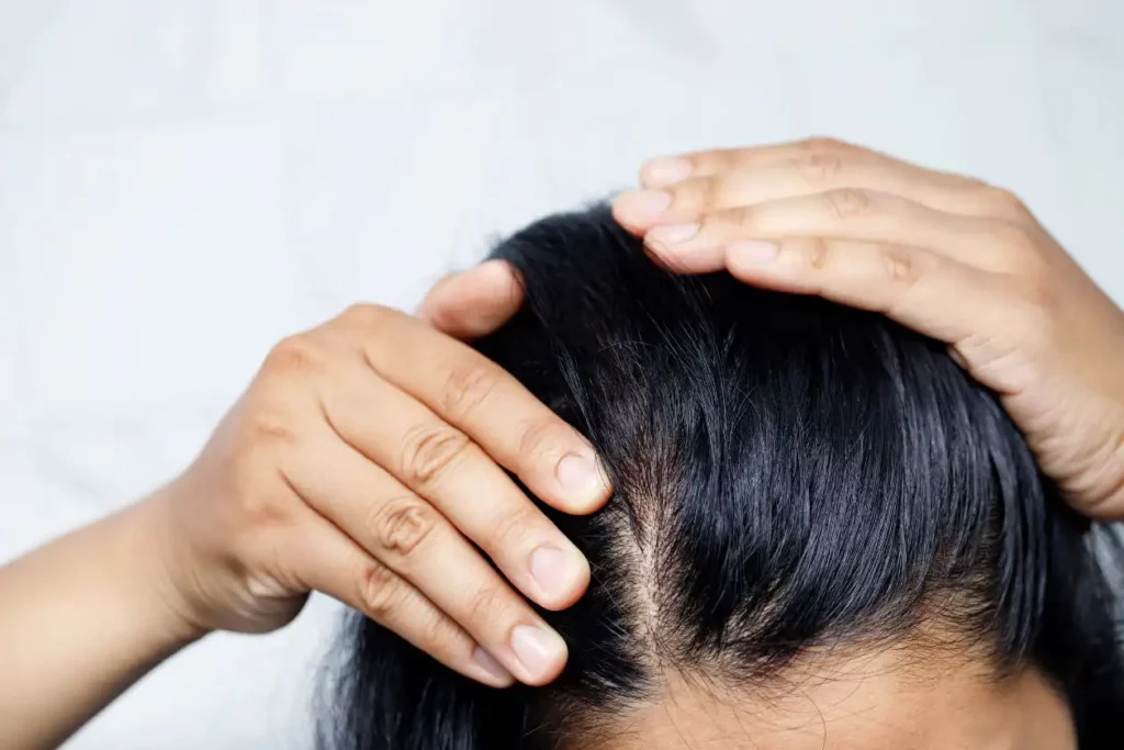 Clean healthy scalp